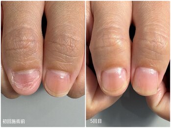 地爪育成