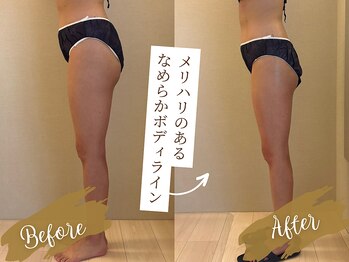 ヴィマ 北堀江(Vima)の写真/【全身サイズダウン】業界歴19年★担当変更なし・マンツーマン施術で年齢に負けない体へ！【四ツ橋/痩身】