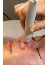 メンズプシュケ(men's PSYCHE)/小鼻の毛穴ケア