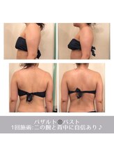 ラ ルミエール(La Lumiere)/ボリュームupだけじゃない！
