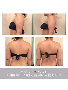 ラ ルミエール(La Lumiere)/ボリュームupだけじゃない！
