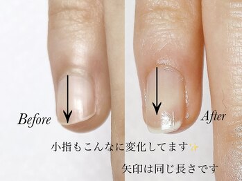 トゥインクリーネイルサロン(Twinkly Nail Salon)/【最強のネイルケア】1回お試し