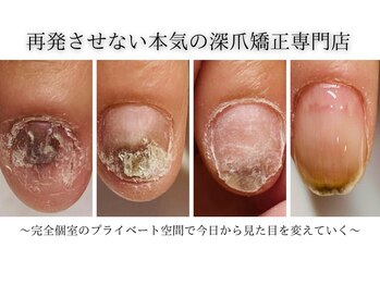 ヴェールリム(verl lim)