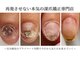 ヴェールリム(verl lim)の写真