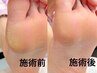 足裏すべすべキャンペーン実施中！隠すより、魅せたくなる足元に¥2980