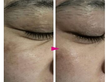 プリオール 高崎花水木店(Prior)/ヒト幹細胞×エステダーマ