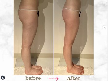 ナチュラーレ 京都四条烏丸店(Naturale)/リンパマッサージ痩身ダイエット