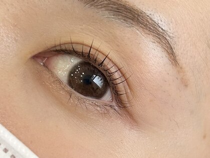 アリビオ(Alivio)の写真