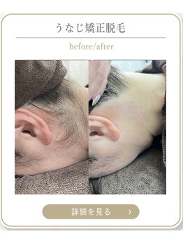 ミース 上野店/上野のうなじ専門店