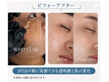 エステアンドアーユルヴェーダサロン サムサーラ(samsara)の雰囲気(暖炉のやわらかい暖かさはほっとしますね♪)