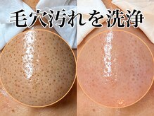 シースタイル(C-S.t.y.l.e.)の雰囲気（毛穴の黒ずみ開き・ざらつき・角栓ケア！毛穴洗浄徹底ケア9800円）