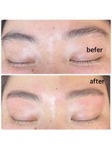 アンジュ グランデ(ange grande)/HBL(ハリウッドブロウリフト)