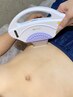 【ハイスペックメンズ全身脱毛】あなたもこれでモテモテ★　49500円⇒19800円