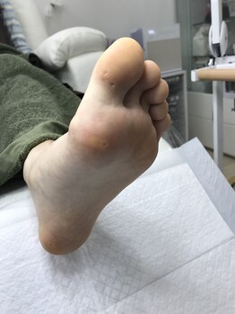 ドクターネイル爪革命 北千住店/トータルフットケア