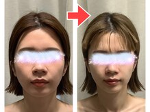 エスボニータ(es bonita)