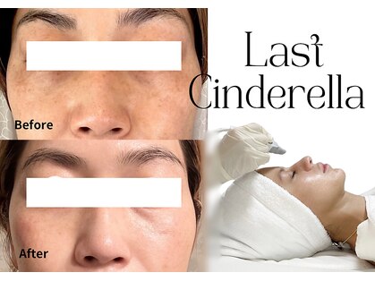 ラストシンデレラ(Last Cinderella)の写真