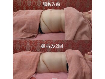 ソワンテラピー(Soin Therapy)/腸もみ+骨盤調整 2回