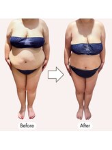 じぶんdeエステ 梅田店/セルフエステ＋施術で-20kg達成!