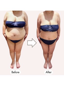 じぶんdeエステ 梅田店/セルフエステ+施術で-20kg達成!