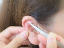 当店では、針を使いませんので痛みはありません