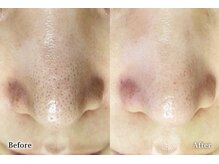 アネル オム 新都心店(ANEL HOMME)/