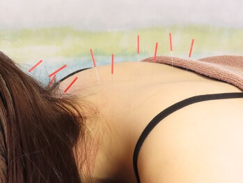 ハウオラ 三軒茶屋(HAUOLA)/施術【首肩こり/自律神経】