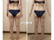 ルシエル ハカタ(Luciel HAKATA)/痩身120分×6ヶ月(30代)