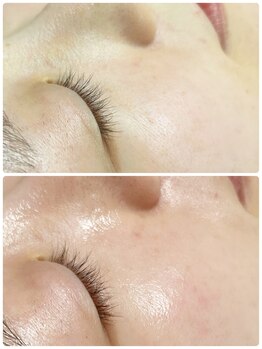 アスピリア(aspirer a')/アマロスハーブピーリング☆