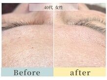 ムク(Muqu.)/くすみがとれると一気に明るい肌