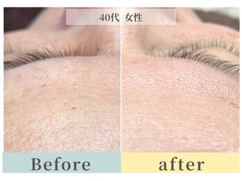 ムク(Muqu.)/くすみがとれると一気に明るい肌