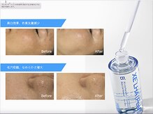 アモ 夢シティ新下関(AMO.)/セラピール