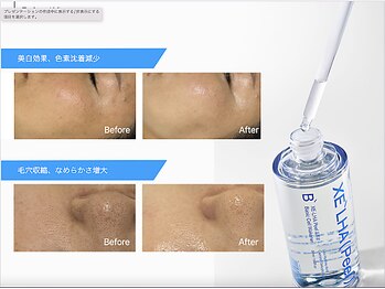 アモ 夢シティ新下関(AMO.)/セラピール