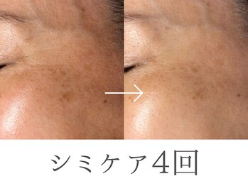 レイミー(reimee)の写真/【皮膚科看護師監修の大人女性の肌管理】結果重視のケアで今も未来も美しい素肌へ
