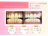 【NEWオープン限定価格】黄ばみ・着色汚れを白くする☆初回体験 ￥3980→￥390