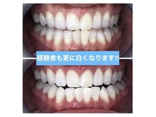 プラチナムビューティー 名古屋栄本店(PLATINUM BEAUTY)/【Before⇒After】