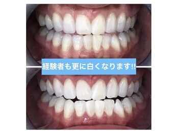 プラチナムビューティー 名古屋栄本店(PLATINUM BEAUTY)/【Before⇒After】