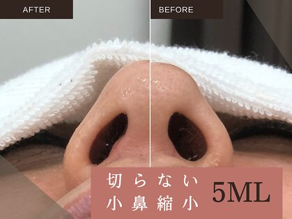 ソルニス(Solnis.)の写真