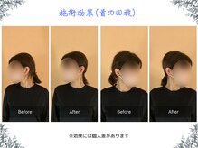 ボディ リセット アンド デザイン(Body Reset & Design)/【施術例】ビフォーアフター