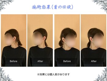ボディ リセット アンド デザイン(Body Reset & Design)/【施術例】ビフォーアフター