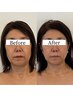 【60歳以上の方必見】美魔女割り引き新規小顔矯正 60分コース¥6,300