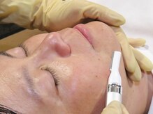 トパーズ 藤枝店(Topaz)/1.お肌状態 剃り残しの確認