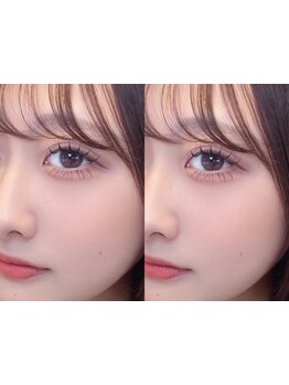 ボリュームのある目元にしたい