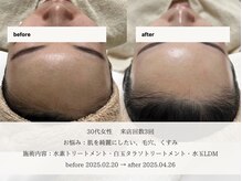 エメ 名古屋栄店(aimer)/SkinCare <肌管理・エイジング>