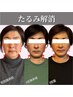 【40歳以上の方迷ったらこれ!】 小顔集中改善コースお試し 約75-90分