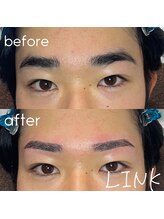 リンク(LINK)/左右差近づけて作ります