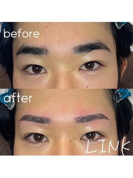 リンク(LINK)/左右差近づけて作ります