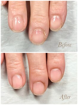 ソワン(soin)/Before→After