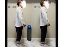 春日整体院ito/【姿勢改善ビフォーアフター】