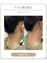 ミース 上野店/うなじケアで変わる♪