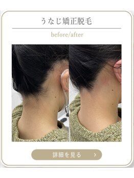 ミース 上野店/うなじケアで変わる♪